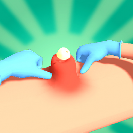Pimple Squeeze